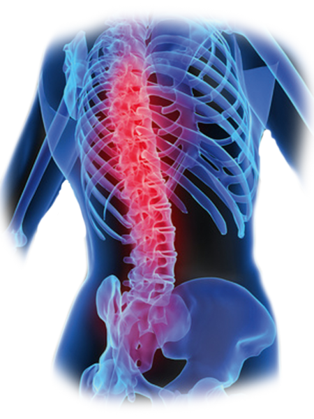 kisspng-low-back-pain-vertebral-column-bone-human-back-5af2b46c2aa7b1.0648830515258553401747